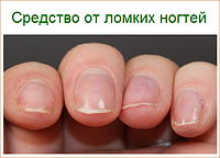 Ламкі нігті на руках що робити