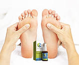 Сангридок - спрей від грибка стопи, фото 4