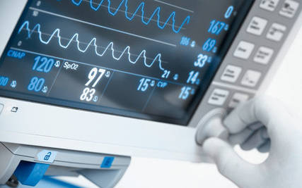 Моніторинг пацієнта