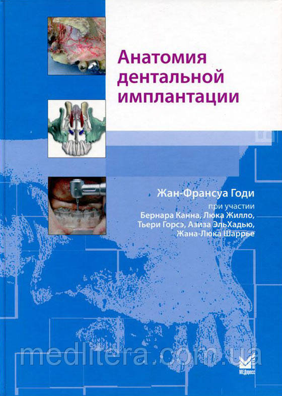 

Годи Жан-Франсуа Анатомия дентальной имплантации