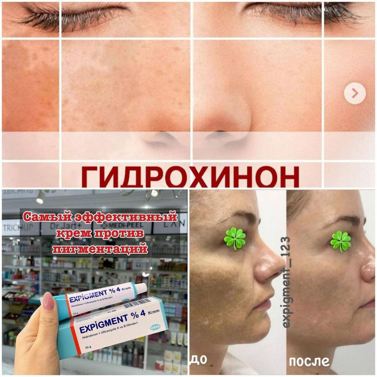 

Отбеливающий крем Экспигмент Expigment, 2%-4%, В наличии