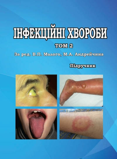 

Інфекційні хвороби Том 2. Андрейчин М.А., Малий В.П.