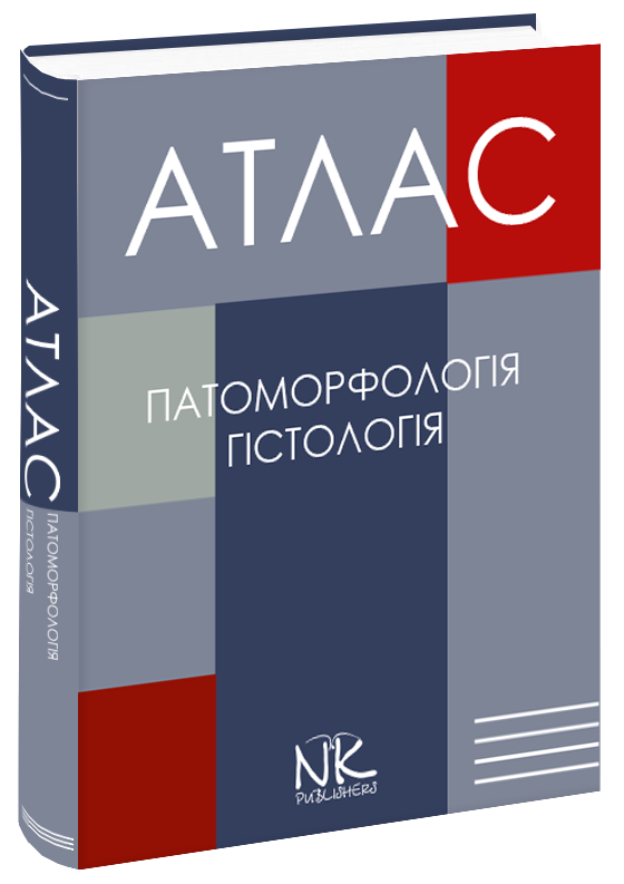 

Атлас з патоморфології та гістології. Зербіно Д. Д. Багрій М. М. Боднар Я. Я.