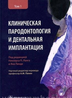 

Ланг Н.П. Клиническая пародонтология и дентальная имплантация : в 2-х т. Том 1