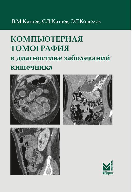 

Китаев В.М., Китаев С.В., Кошелев Э.Г. Компьютерная томография в диагностике заболеваний кишечника 2020 год