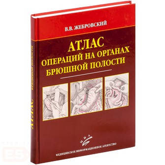 

Жебровский В.В. Атлас операций на органах брюшной полости