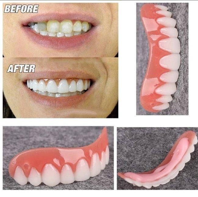 

Виниры Perfect Smile Veneers