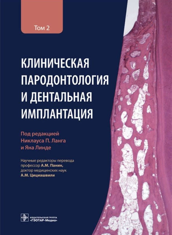 

Ланг Н.П. Клиническая пародонтология и дентальная имплантация : в 2-х т. Том 2