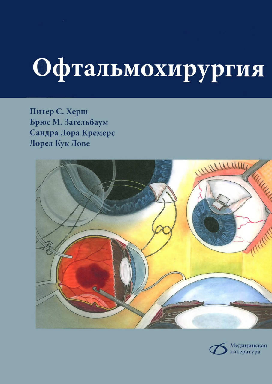 

Офтальмохирургия Питер С. Херш 2020г.