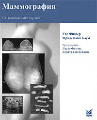 

Фишер У. Маммография. 100 клинических случаев