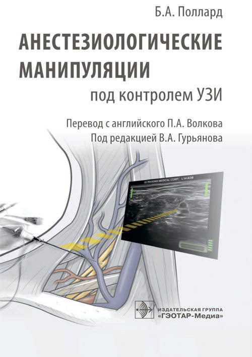 

Поллард Б.А. П.А. Волкова Анестезиологические манипуляции под контролем УЗИ 2021 год