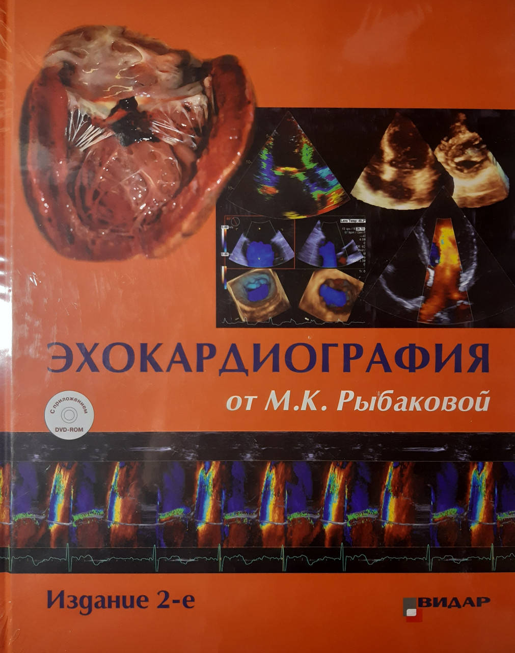 

Рыбакова М.К. Эхокардиография от М.К. Рыбаковой. Руководство 2-е издание 2018 год