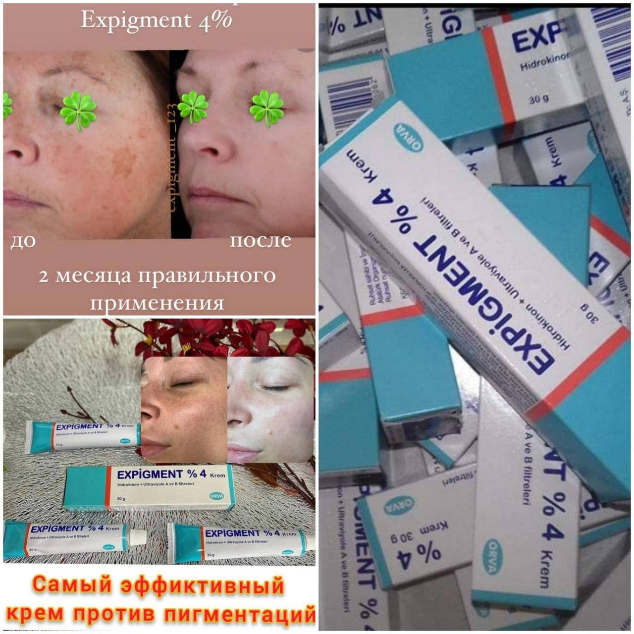 

Отбеливающий крем Экспигмент Expigment, 2%-4%, В наличии