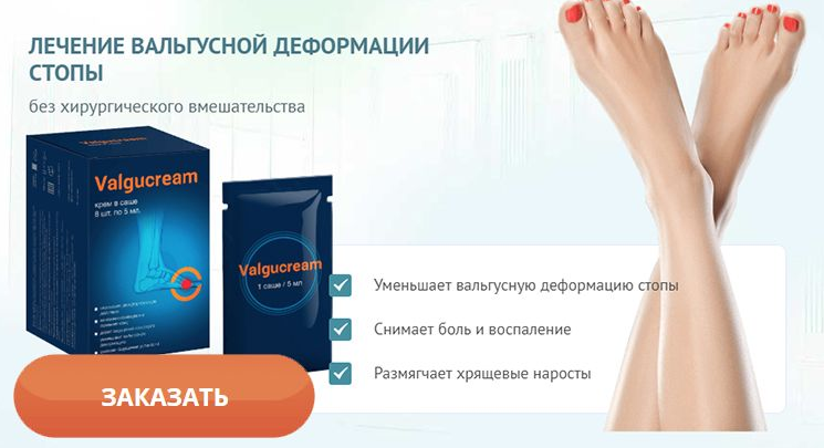 

Valgucream - Крем от вальгусной деформации (ВальгусКрем)