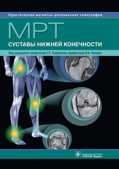 

Труфанов Г.Е. МРТ. Суставы нижней конечности. Руководство 2018 год