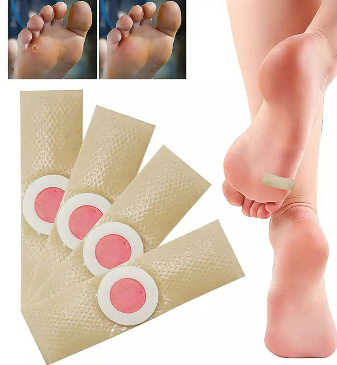 

Пластырь от сухих мозолей, бородавок, натоптышей (6 штук)