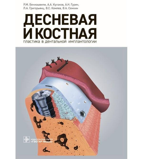 

Десневая и костная пластика в дентальной имплантологии Р. М. Бениашвили 2017г.