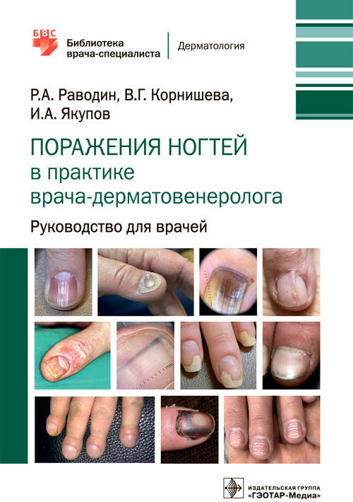

Поражения ногтей в практике врача- дерматовенеролога Раводин Р.А 2022г.