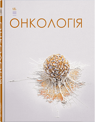 

Онкологія. Шевченко А.І. та ін.