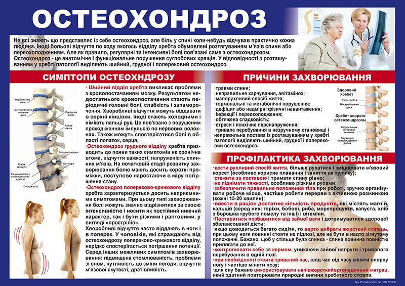 

Санбюллетень "Остеохондроз" А1(600*840 мм), Плёнка