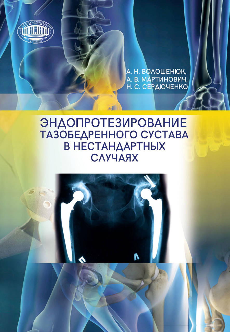 

Эндопротезирование тазобедренного сустава в нестандартных случаях