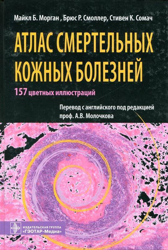 

Морган М.Б., Сомач С.К., Смоллер Б.Р. Атлас смертельных кожных болезней