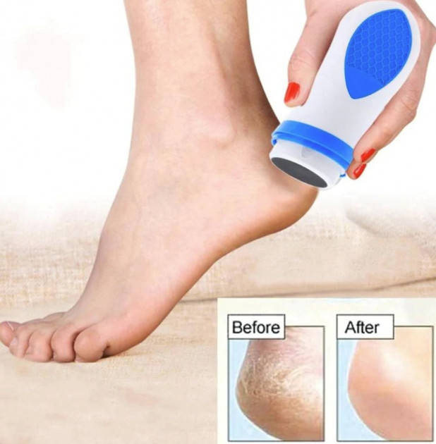 

Электрическая пемза Набор для педикюра Pedi Spin ! Quality