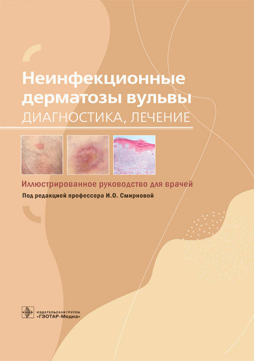 

И.О. Смирновой Неинфекционные дерматозы вульвы. Диагностика, лечение. Иллюстрированное руководство 2021 год