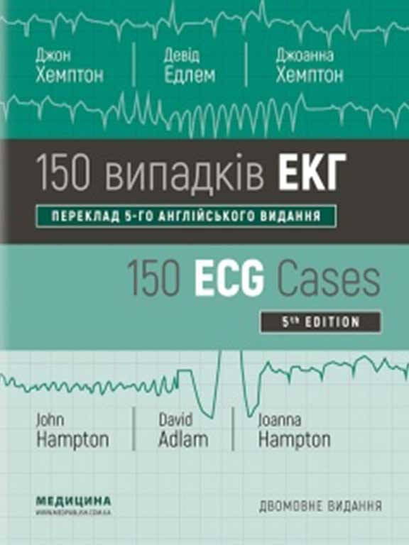 

150 випадків ЕКГ=150 ECG Cases Хемптон