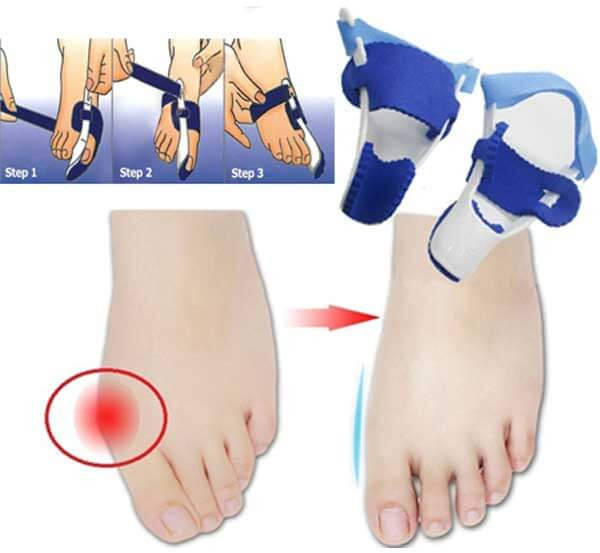 

Вальгусный ночной бандаж