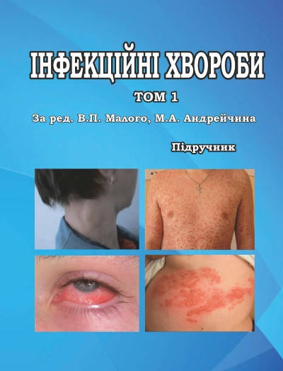 

Інфекційні хвороби Том 1. Андрейчин М.А., Малий В.П.