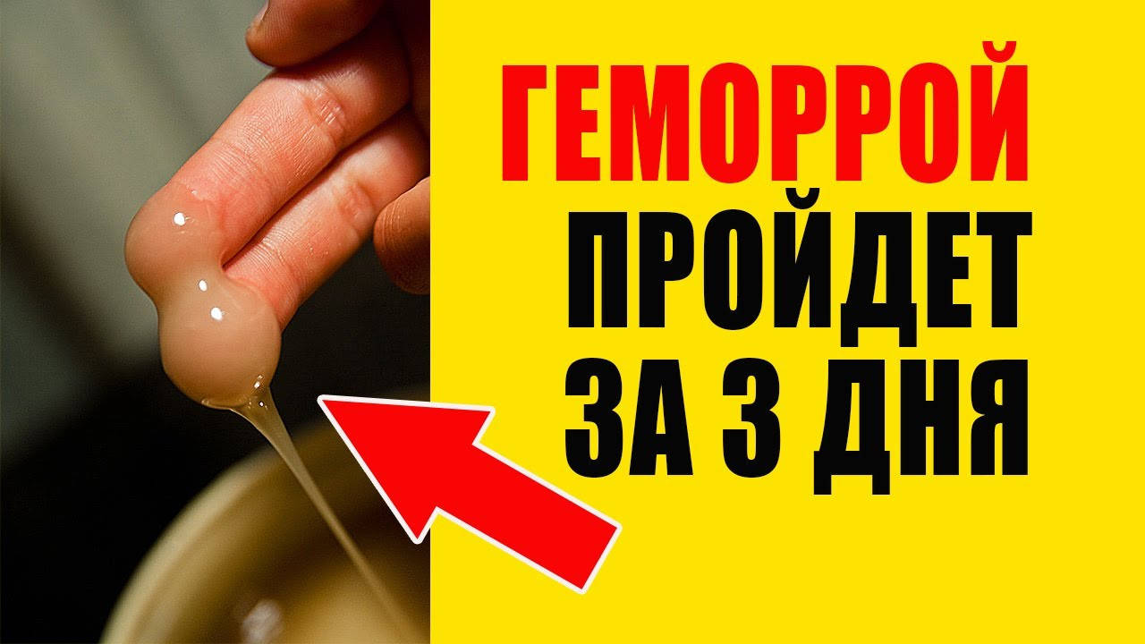 

Лучшее средство от геморроя - это