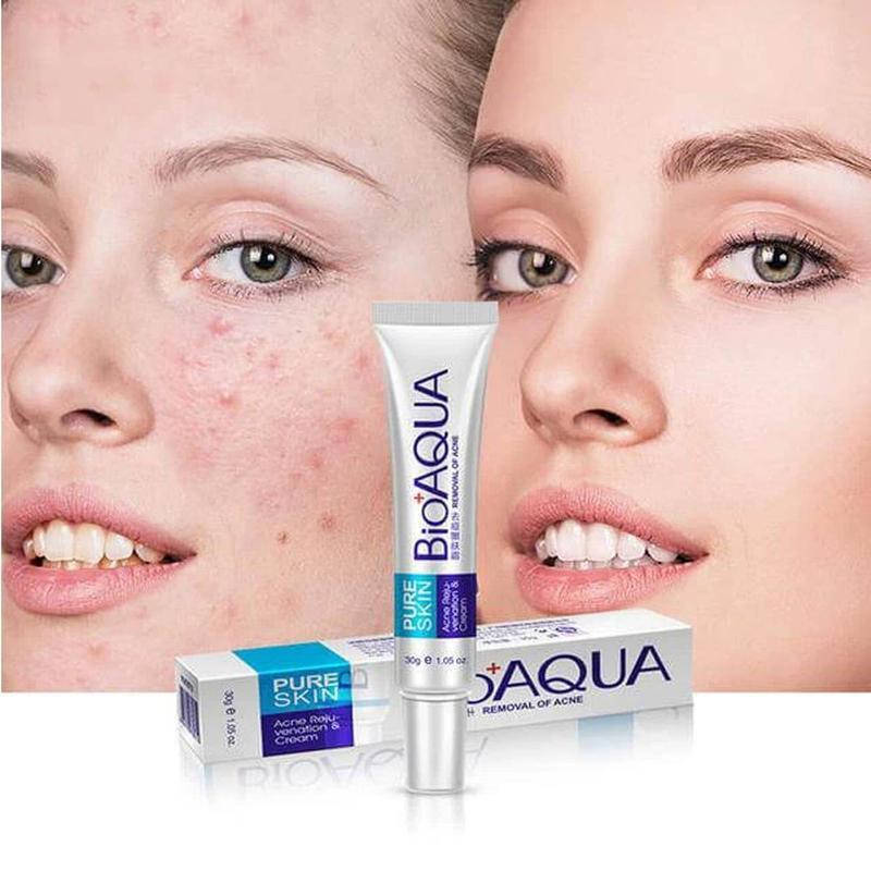 

Крем от акне рубцов воспалений bioaqua pure skin, крем для проблемной кожи 30 мл