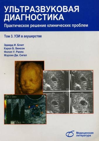 

Эдвард И.Блют Ультразвуковая диагностика. Практическое решение клинических проблем. Том 3. Узи в акушерстве