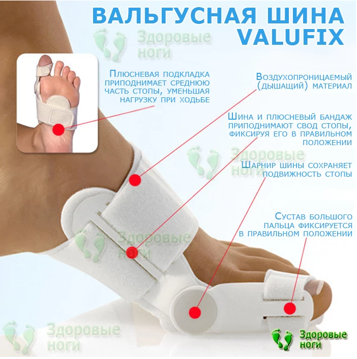 

ValuFix Вальгусная ортопедическая магнитная шарнирная шина (ВалюФикс)