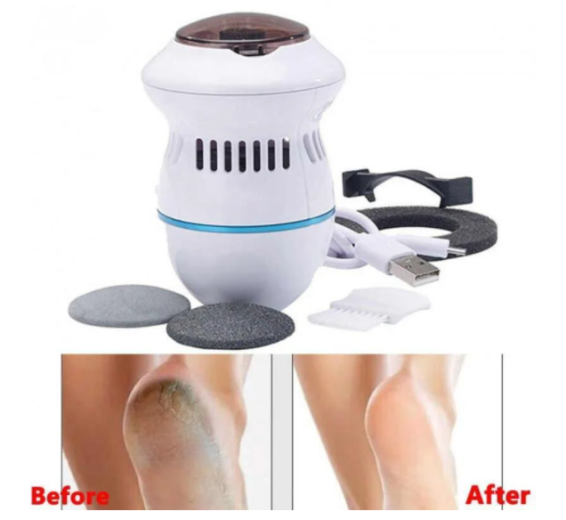 

Электрическая пемза PEDI VAC, прибор для удаления мозолей Педи вак
