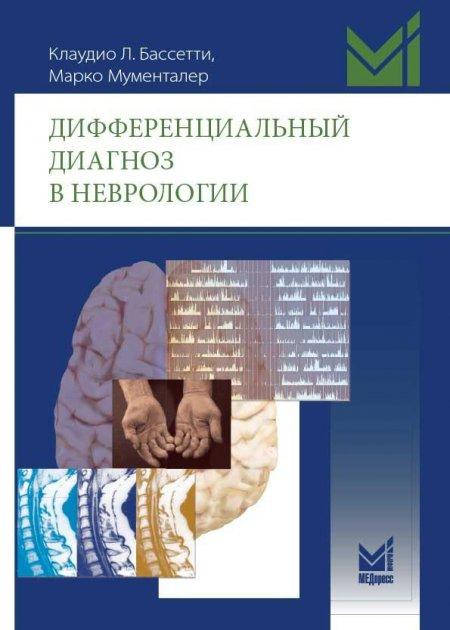 

Дифференциальный диагноз в неврологии Марко Мументалер 2017год(е поддержки НЕТ)