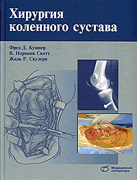 

Кушнер Ф.Д. Хирургия коленного сустава