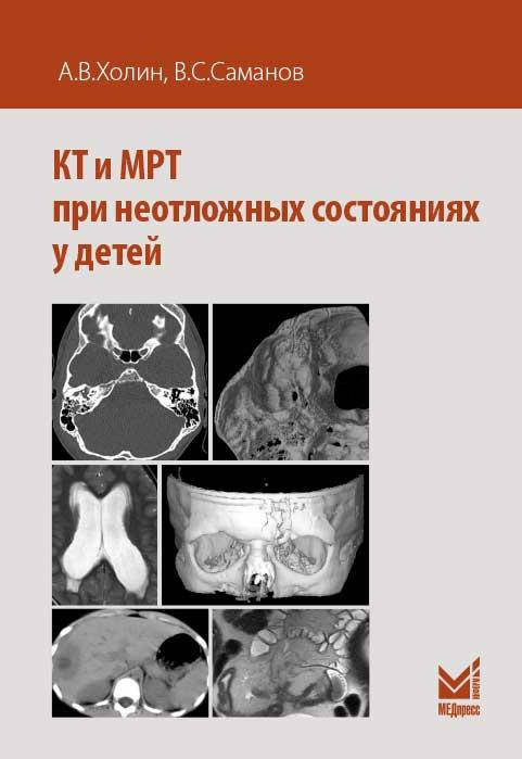 

Холин А.В. КТ и МРТ при неотложных состояниях у детей 2019 год