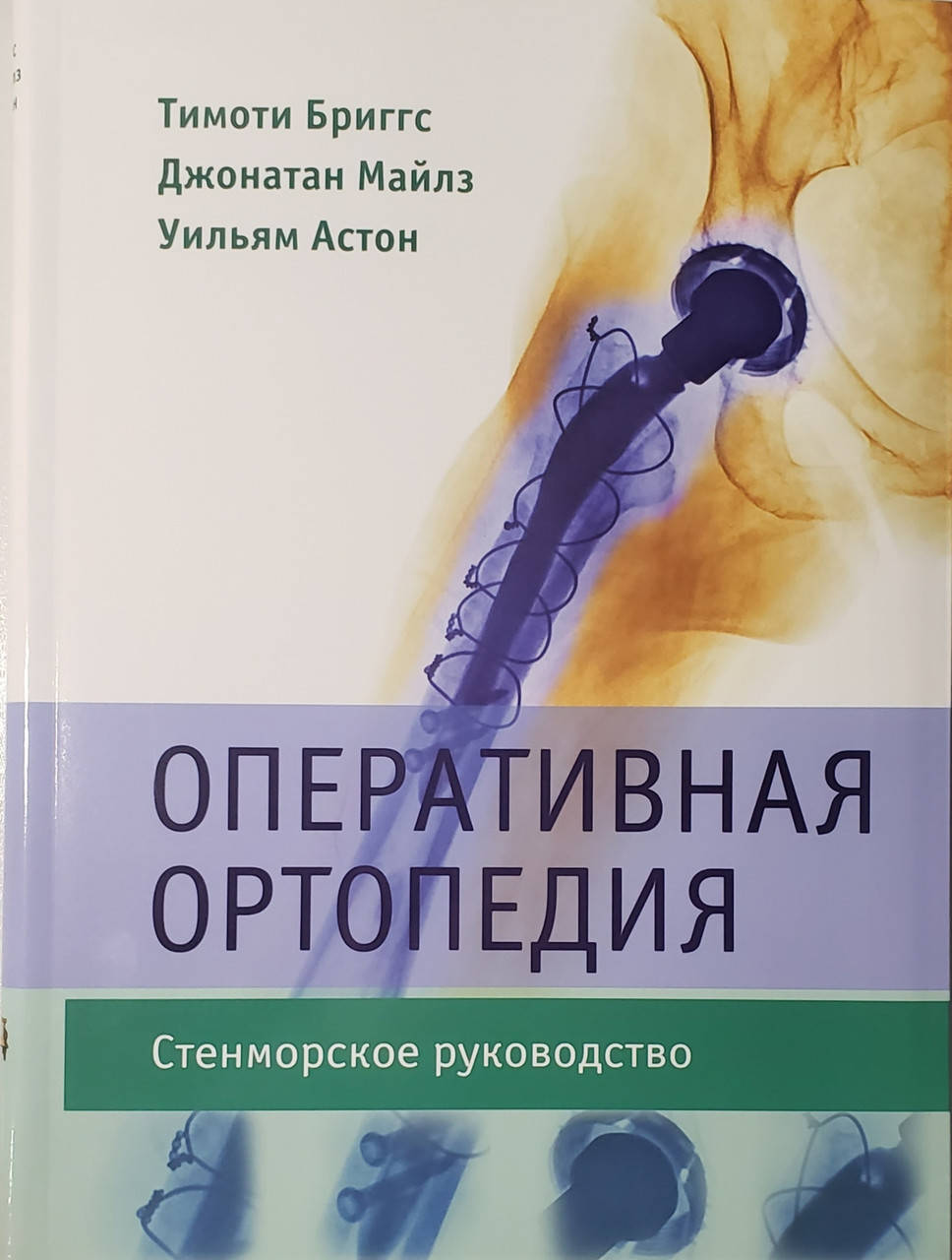 

Бриггс Т., Майлз Дж., Астон У. Оперативная ортопедия. Стенморское руководство