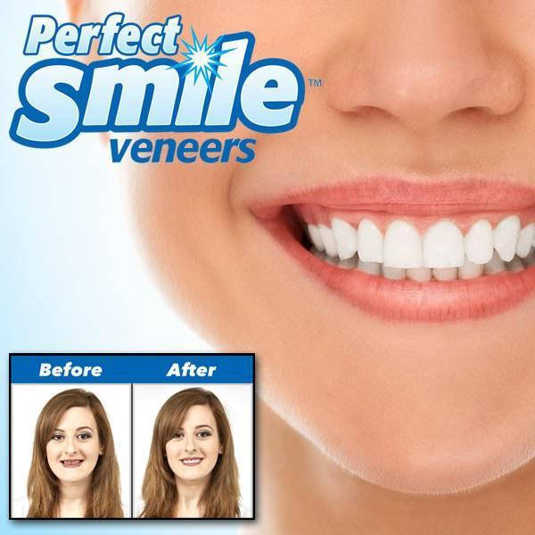 

Виниры для зубов Perfect Smile Veneers