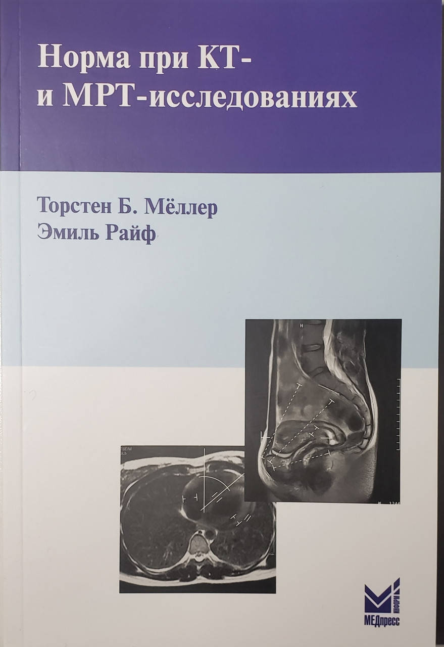 

Торстен Б. Меллер, Эмиль Райф Норма при КТ- и МРТ-исследованиях 2020 год