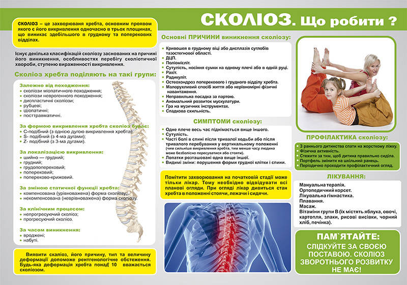 

Санбюллетень "Сколиоз"