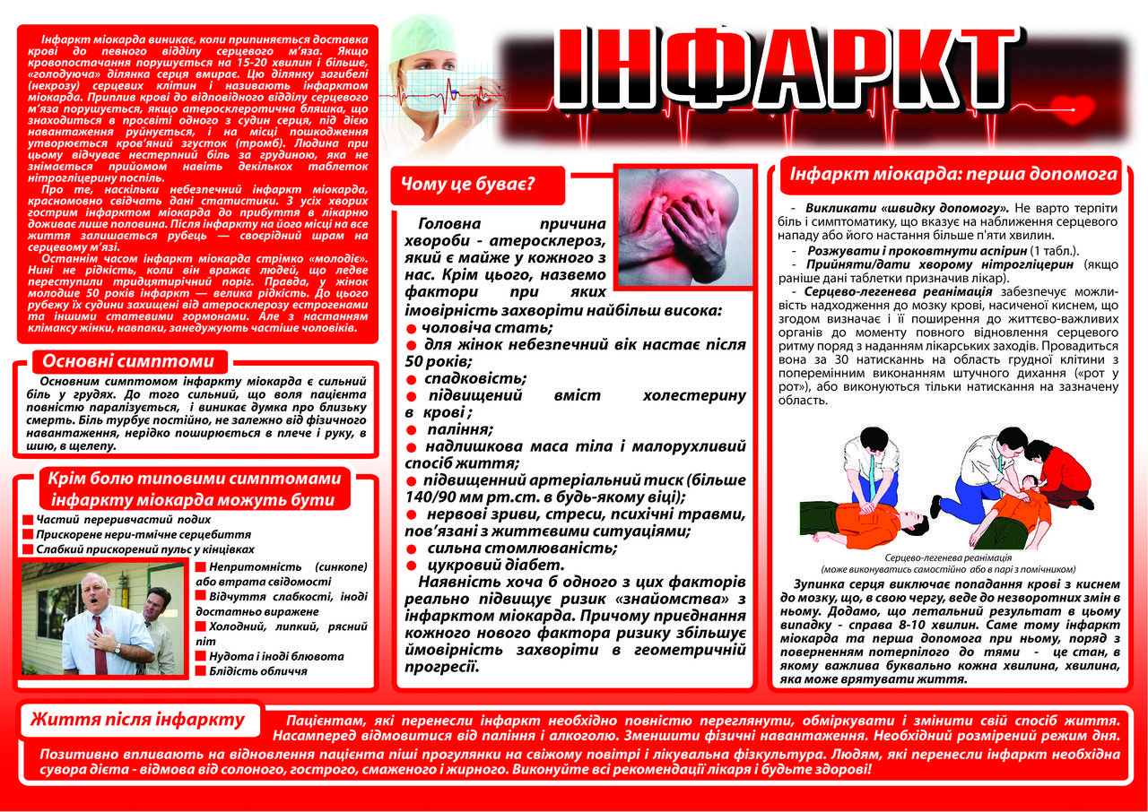 

Санбюллетень "Инфаркт"