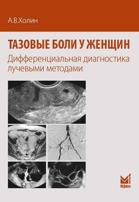 

Холин А.В. Тазовые боли у женщин. Дифференциальная диагностика лучевыми методами
