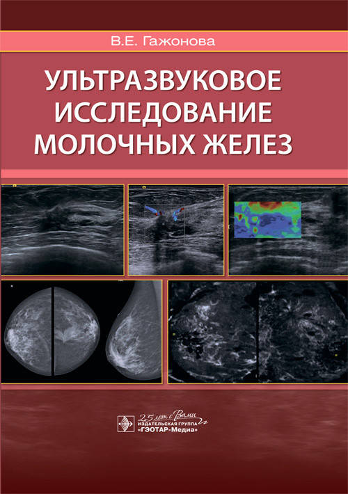 

Ультразвуковое исследование молочных желез / В. Е. Гажонова. 2022 год