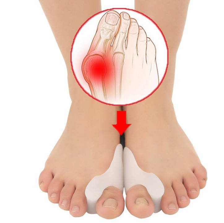 

Силиконовый протектор на косточку с межпальцевой перегородкой HM Heels