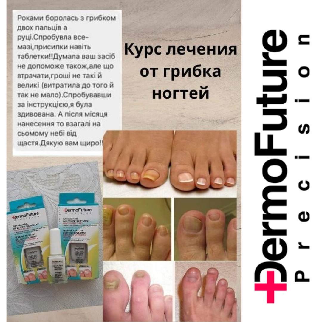 

Эффективный лак лечебный против грибка ногтей Dermofuture, 9 мл
